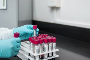 La eliminación de residuos sanitarios se realiza, generalmente por incineración.
